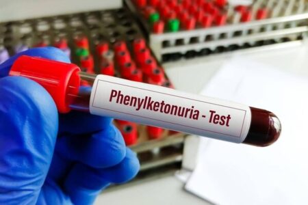 خبر خوش برای بیماران PKU؛ توزیع نان فاقد پروتئین