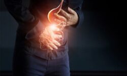 مدیریت رفلاکس در ماه رمضان؛ افطار سبک، معده سالم